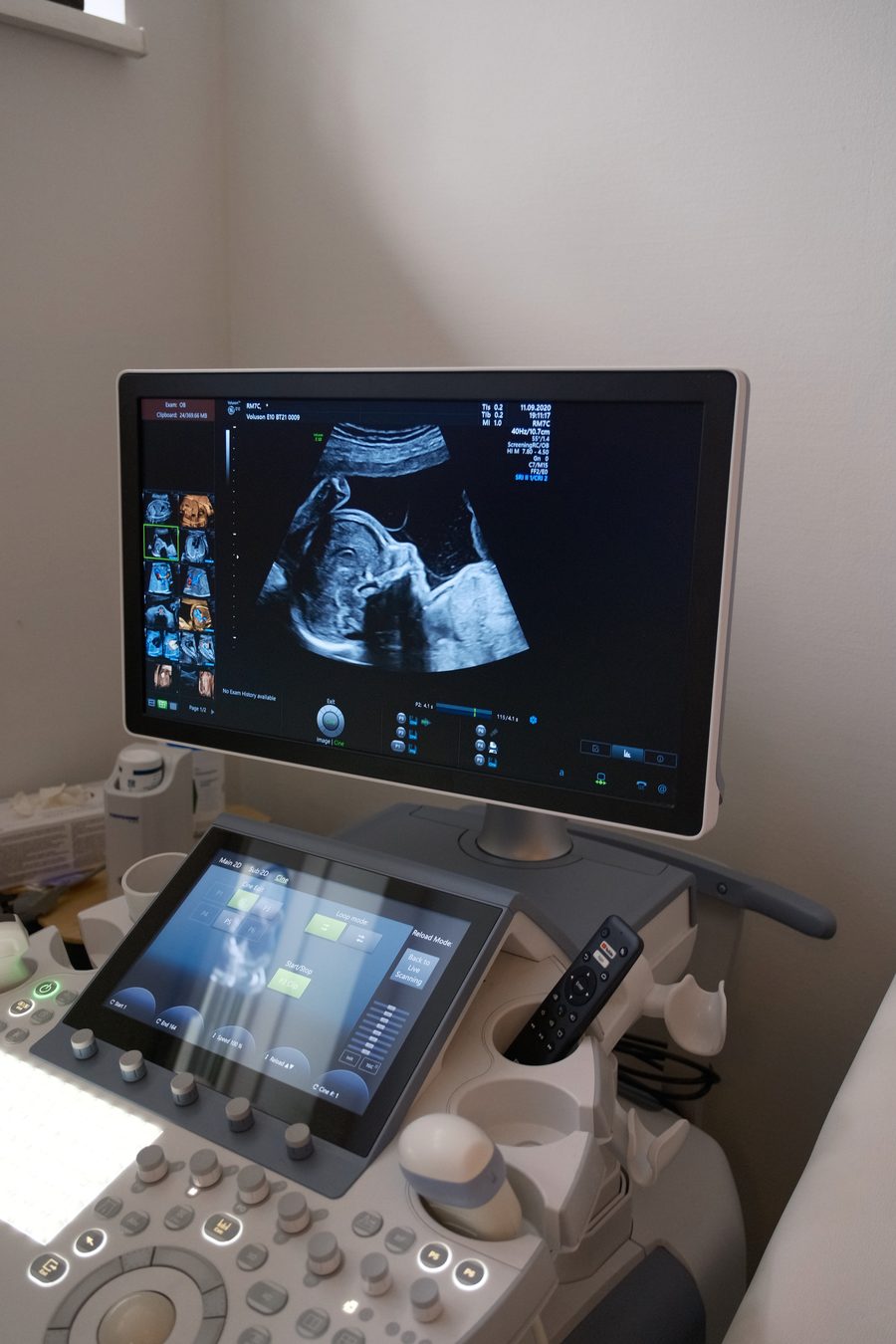 Echoapparaat met een scan op het scherm